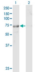 FLJ30990 Antibody in Western Blot (WB)