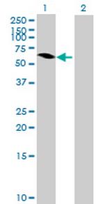 MAGEB6 Antibody in Western Blot (WB)