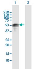 SPRED1 Antibody in Western Blot (WB)