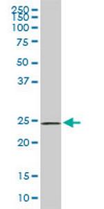 PHOSPHO1 Antibody in Western Blot (WB)