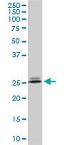 PHOSPHO1 Antibody in Western Blot (WB)