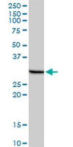 PHOSPHO1 Antibody in Western Blot (WB)