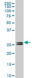 PHOSPHO1 Antibody in Western Blot (WB)