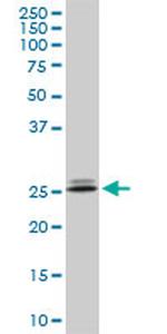 PHOSPHO1 Antibody in Western Blot (WB)