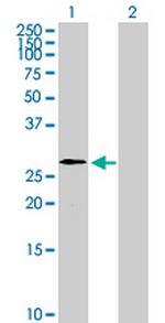 WBP2NL Antibody in Western Blot (WB)