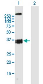 OXER1 Antibody in Western Blot (WB)