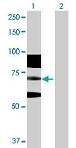 RNF168 Antibody in Western Blot (WB)