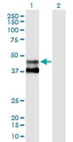 MMAA Antibody in Western Blot (WB)