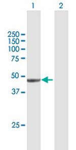 DCP2 Antibody in Western Blot (WB)