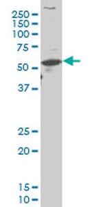 ARX Antibody in Western Blot (WB)