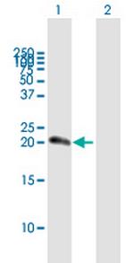 NUDT10 Antibody in Western Blot (WB)