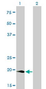 NUDT10 Antibody in Western Blot (WB)