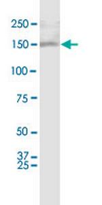 ASXL1 Antibody in Western Blot (WB)