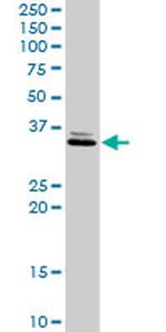 RDHE2 Antibody in Western Blot (WB)