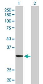 RDHE2 Antibody in Western Blot (WB)