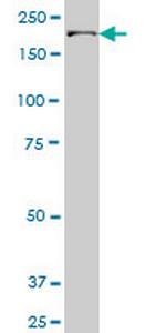 UBR1 Antibody in Western Blot (WB)