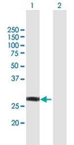 NSMCE1 Antibody in Western Blot (WB)