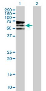 PIP5K3 Antibody in Western Blot (WB)