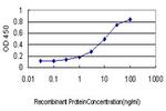 PIP5K3 Antibody in ELISA (ELISA)