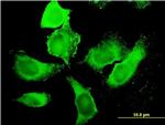 PIP5K3 Antibody in Immunocytochemistry (ICC/IF)