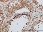 PIP5K3 Antibody in Immunohistochemistry (Paraffin) (IHC (P))