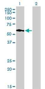 PIP5K3 Antibody in Western Blot (WB)