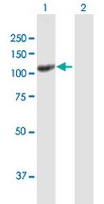 UNC13D Antibody in Western Blot (WB)