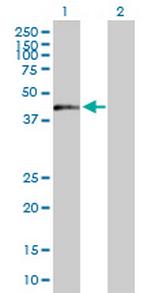 ZNF584 Antibody in Western Blot (WB)