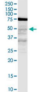 LASS3 Antibody in Western Blot (WB)