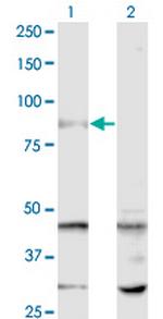 SENP5 Antibody in Western Blot (WB)