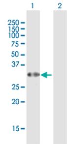 C6ORF206 Antibody in Western Blot (WB)