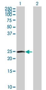 IL27 Antibody in Western Blot (WB)