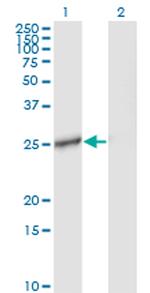 IL27 Antibody in Western Blot (WB)