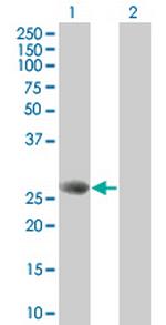 STXBP4 Antibody in Western Blot (WB)