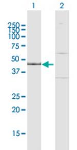 IPMK Antibody in Western Blot (WB)