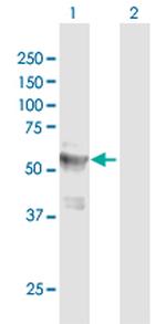 LPCAT4 Antibody in Western Blot (WB)