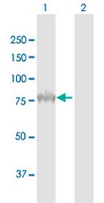 PCSK9 Antibody in Western Blot (WB)