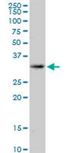 KCNRG Antibody in Western Blot (WB)