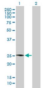 PLA2G4D Antibody in Western Blot (WB)