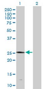 PLA2G4D Antibody in Western Blot (WB)