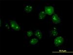 TTLL6 Antibody in Immunocytochemistry (ICC/IF)