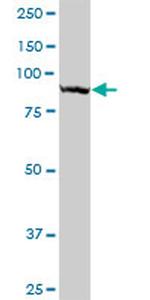 TTLL6 Antibody in Western Blot (WB)