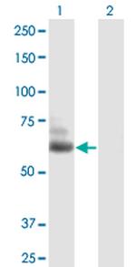 TTLL6 Antibody in Western Blot (WB)