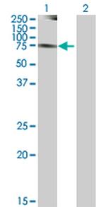 NEK8 Antibody in Western Blot (WB)