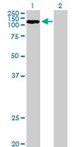 CCDC66 Antibody in Western Blot (WB)