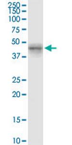 MYLK4 Antibody in Western Blot (WB)