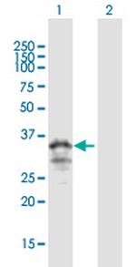 MOGAT3 Antibody in Western Blot (WB)