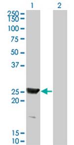 RAB15 Antibody in Western Blot (WB)