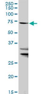 SLC27A1 Antibody in Western Blot (WB)