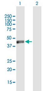 NSUN4 Antibody in Western Blot (WB)